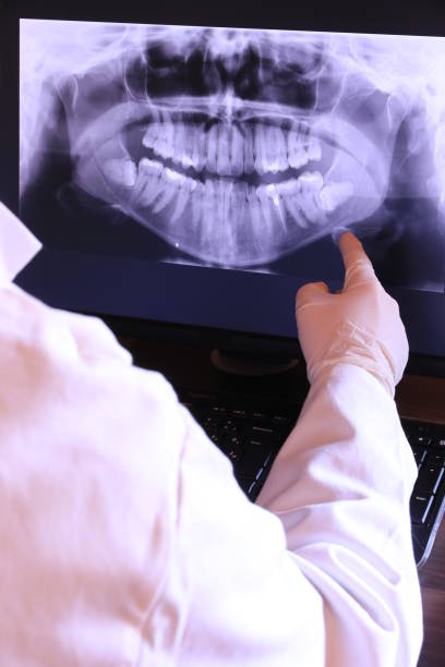 Best Emergency Root Canal Treatment in Burbank, CA