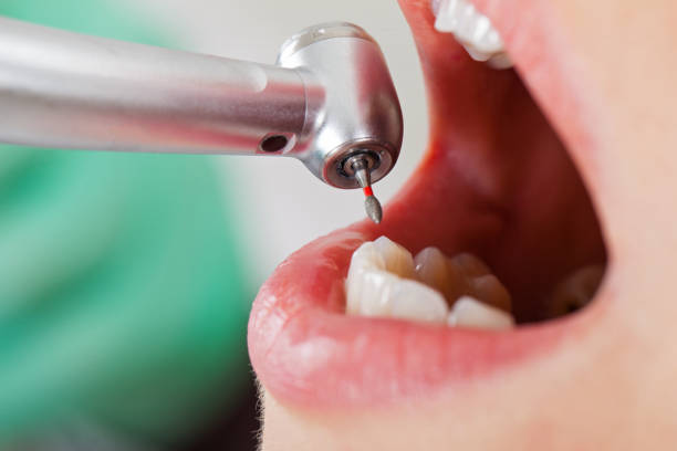 Best Emergency Treatment for Toothache in Burbank, CA